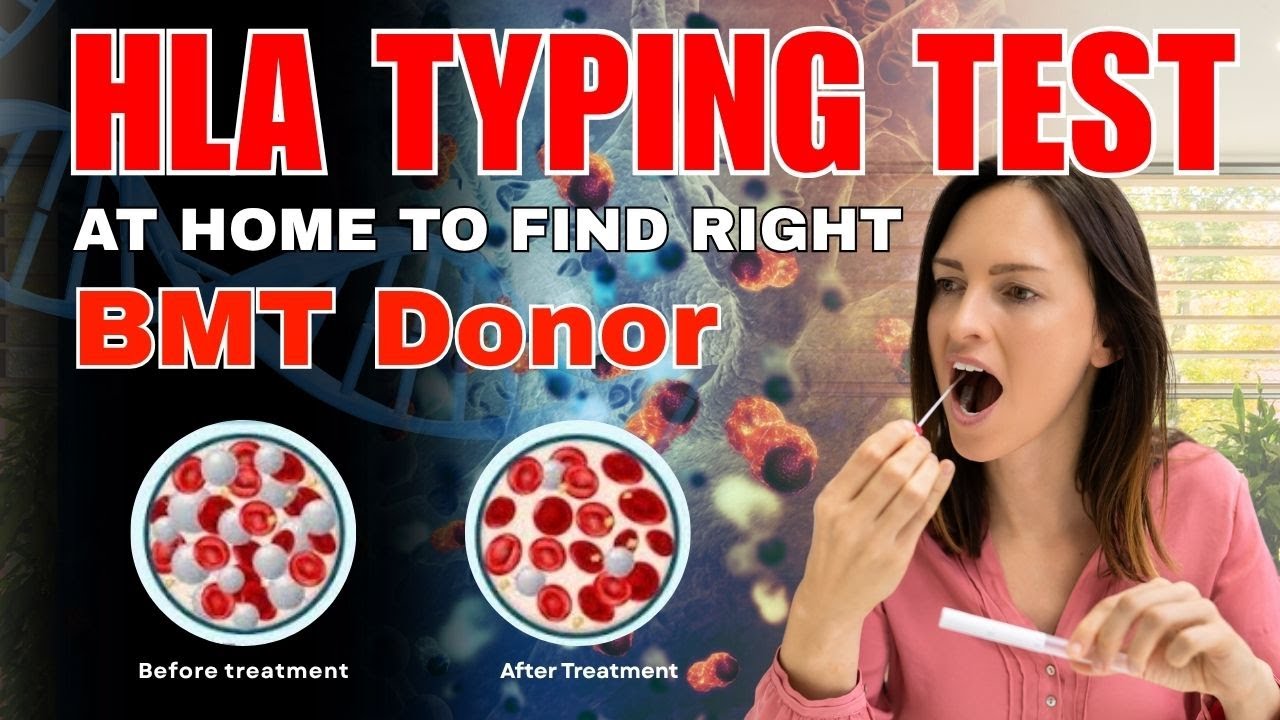 HLA Matching for Bone Marrow Transplant | FIND the Perfect BMT Donor