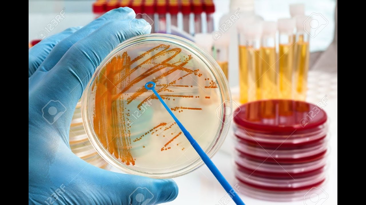Gram Positive Bacilli