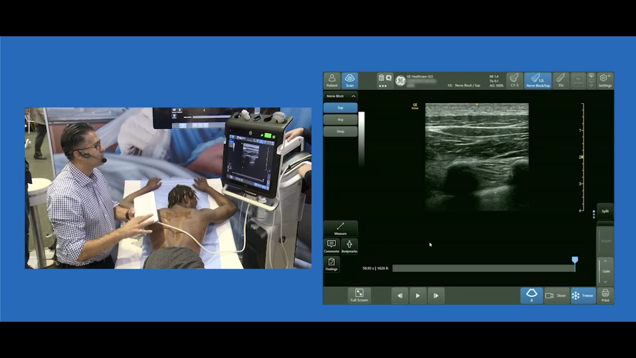 Paramedian Sagittal Approach to Thoracic Paravertebral Block