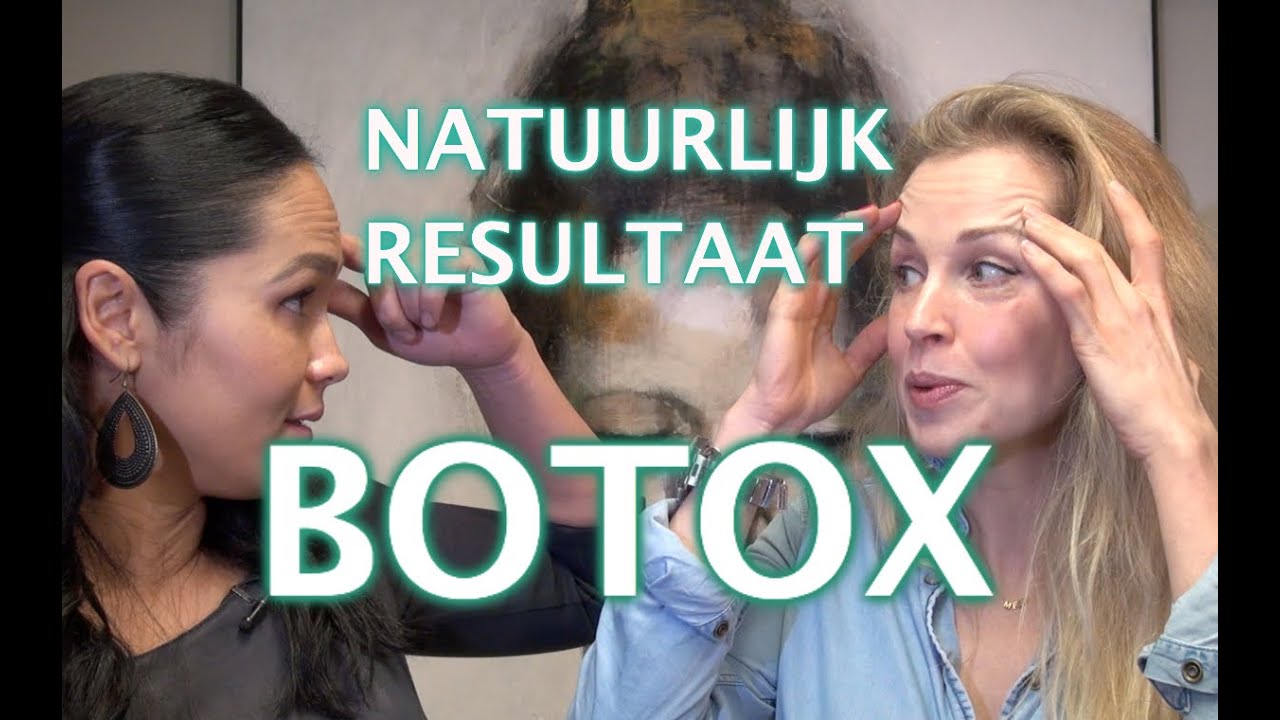 NATUURLIJK RESULTAAT met botox | FURROW.NL