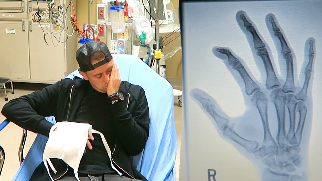 I BROKE MY HAND...