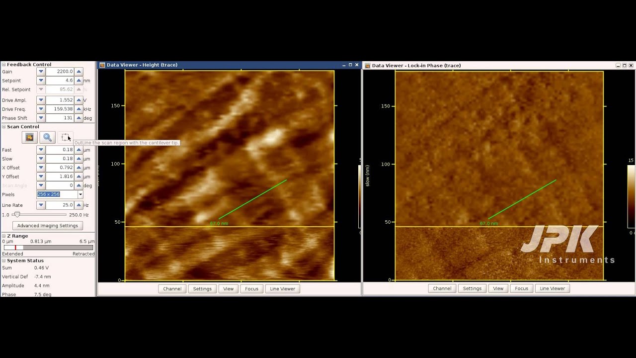 Atomic Force Microscopy - Fast scanning of collagen type I