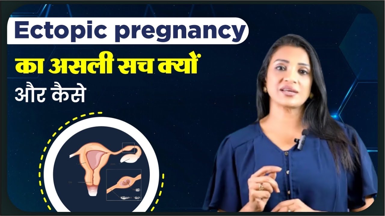 Ectopic pregnancy का असली सच क्यों और कैसे || Ask your gynaecologist || Sonal Parihar