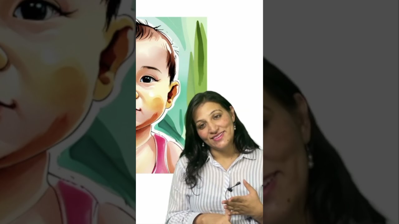 Stork bites in kids
