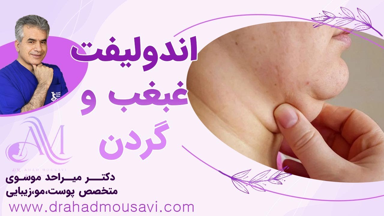 اندولیفت غبغب و گردن محبوب ترین لیزر این روزها