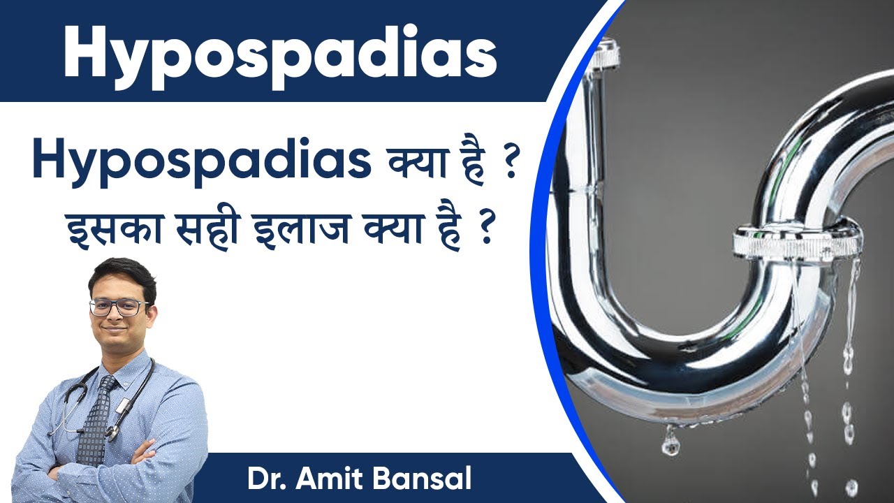 Hypospadias क्या है? Hypospadias का इलाज कब कराएँ ? Hypospadias in Hindi