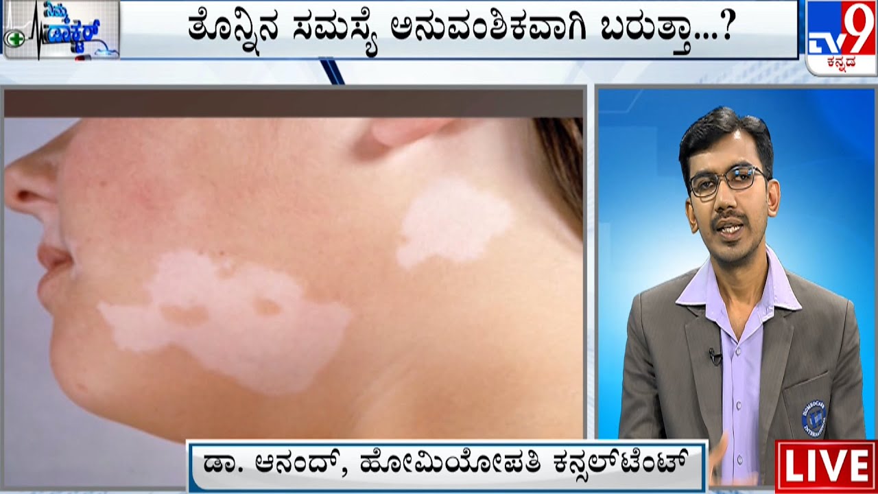 Nimma Doctor | Homeopathic Treatment For Vitiligo Skin Problem | Homeocare International