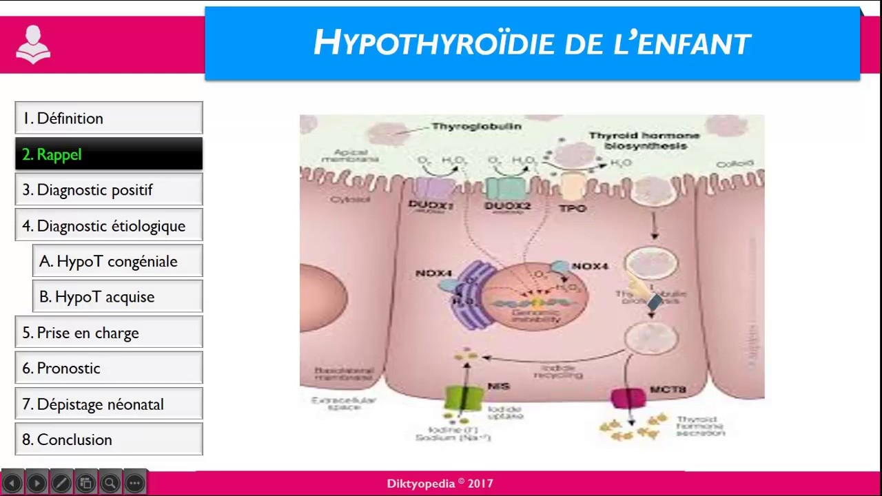 Hypothyroïdie de l’enfant