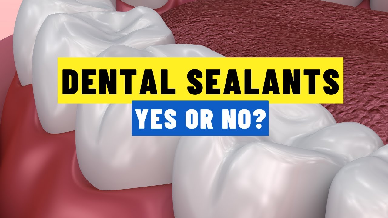 What’s REALLY In Your Child’s Sealants? Watch Before You Say Yes!