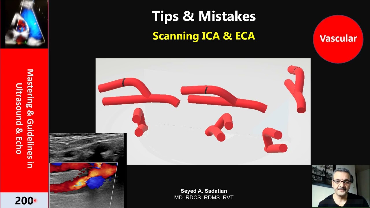 announcement :Tips & Mistakes: Scanning ECA & ICA