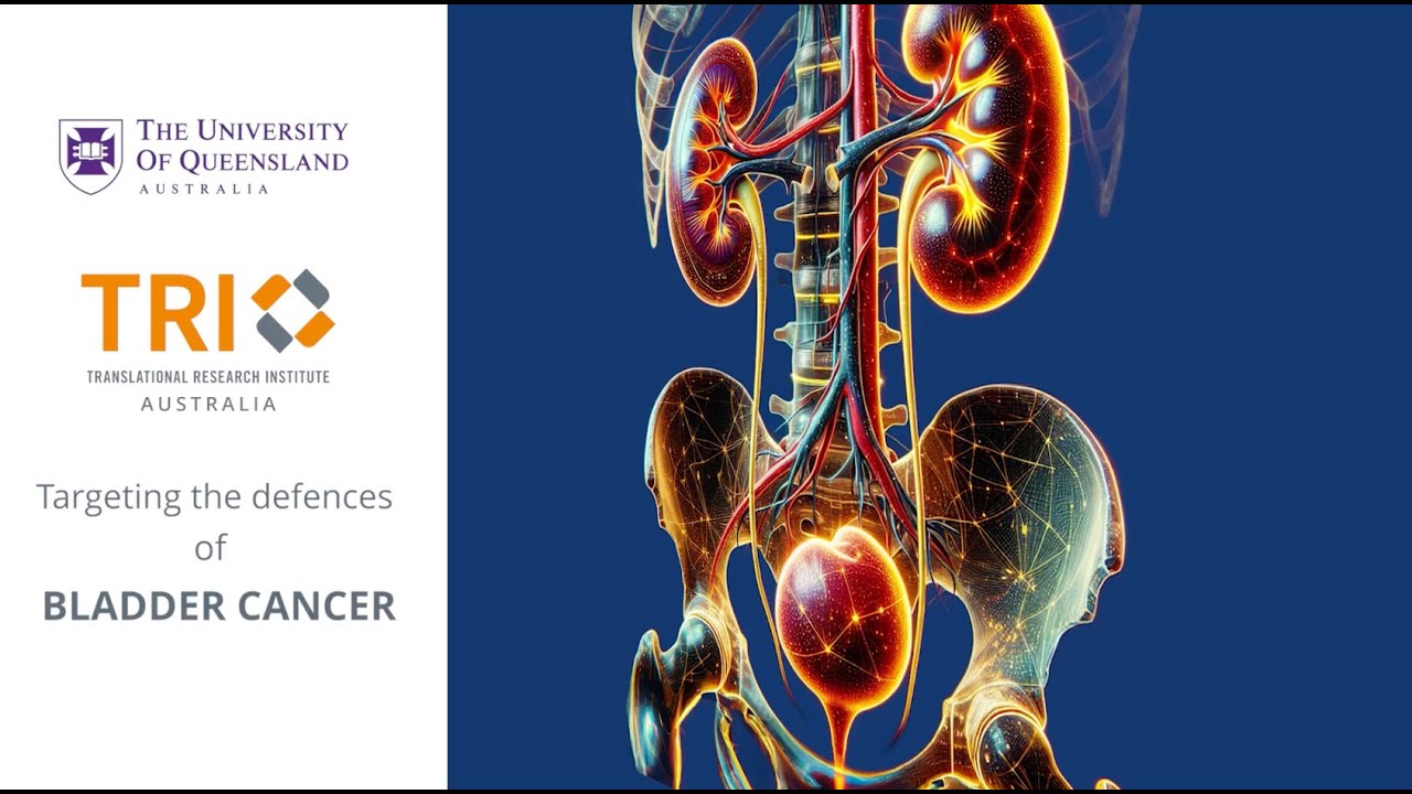 Potential new treatment pathway for bladder cancer
