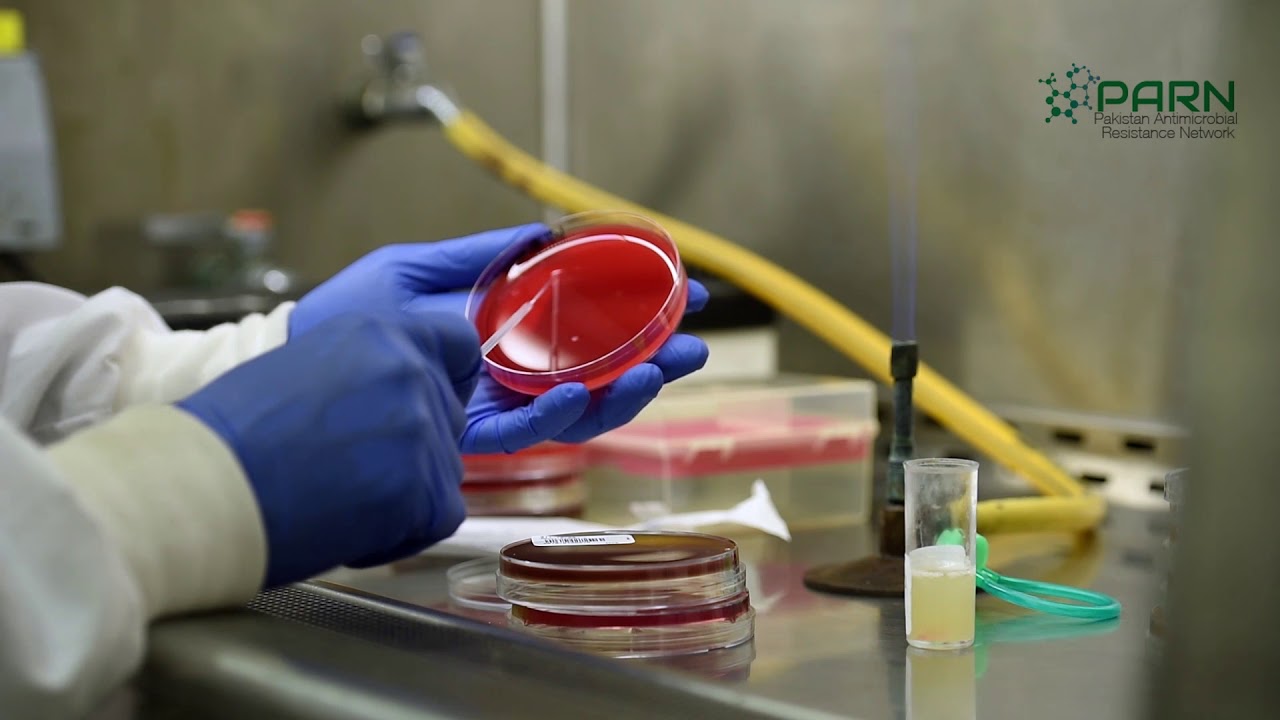 Processing of respiratory tract specimens