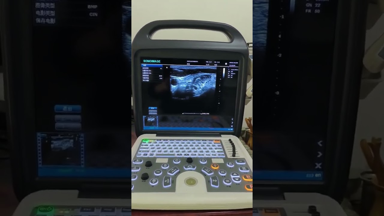 P50 Portable Ultrasound | Linear Probe B-Mode Imaging | Vascular & Superficial Scans