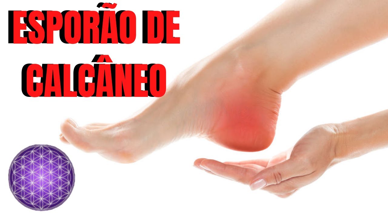 Esporão de calcaneo/ Fascite Plantar -  Resolva com Reflexologia Podal