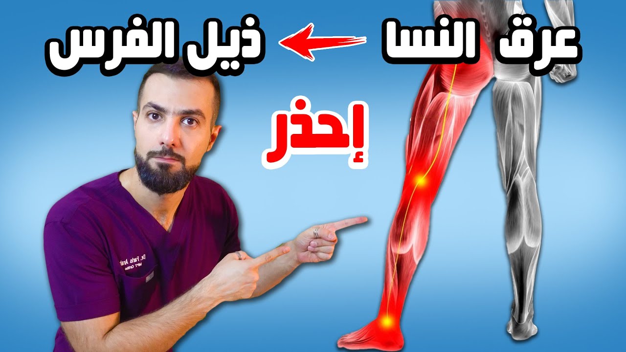 عرق النسا أو دسك الظهر مع سلس البول وخدر العانة || احذر متلازمة ذيل الفرس Cauda Equina
