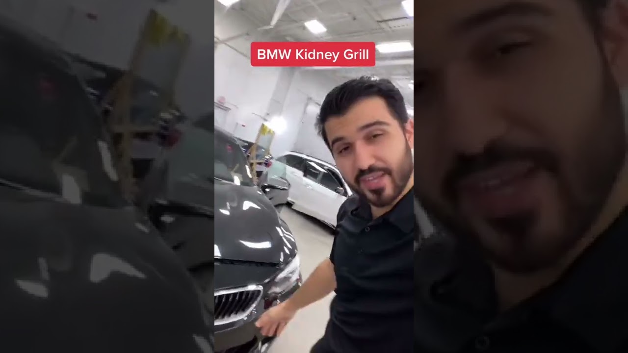 BMW KIDNEY GRILLE REMOVAL!!