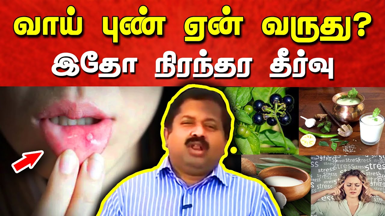 வாய் புண்ணுக்கு நிரந்தர தீர்வு! Dr. Sivaraman speech in Tamil | Mouth Sores | Tamil speech box