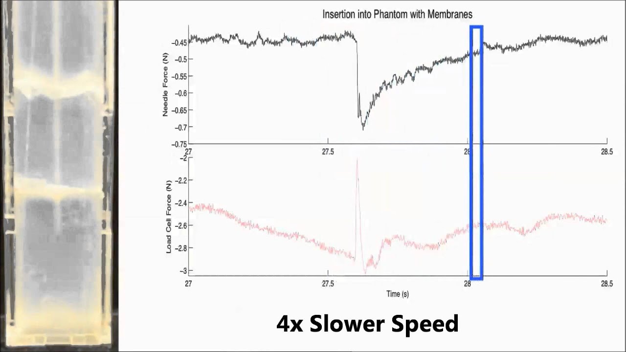 Tip Force Sensing Needle in a Tissue Phantom