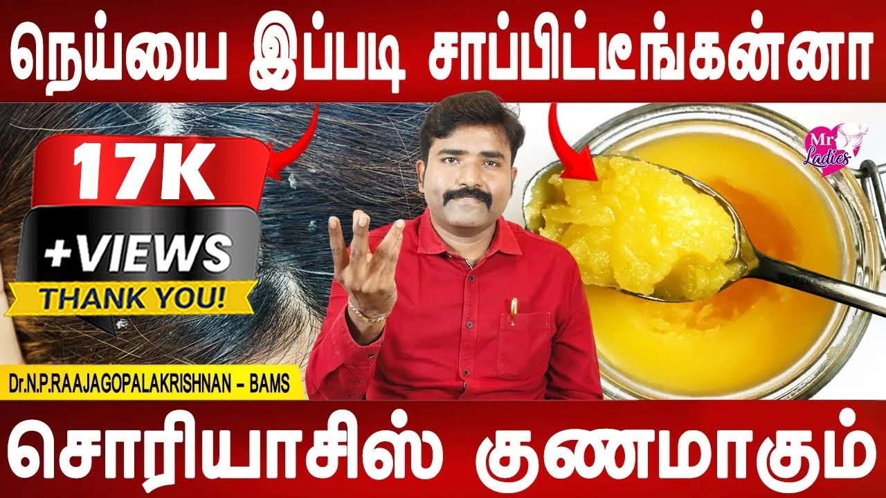 பொடுகுன்னு அலட்சியமா விட்டுறாதீங்க இந்த நோய்க்கு கொண்டு போய் விடும் | Psoriasis remedy | Mr ladies