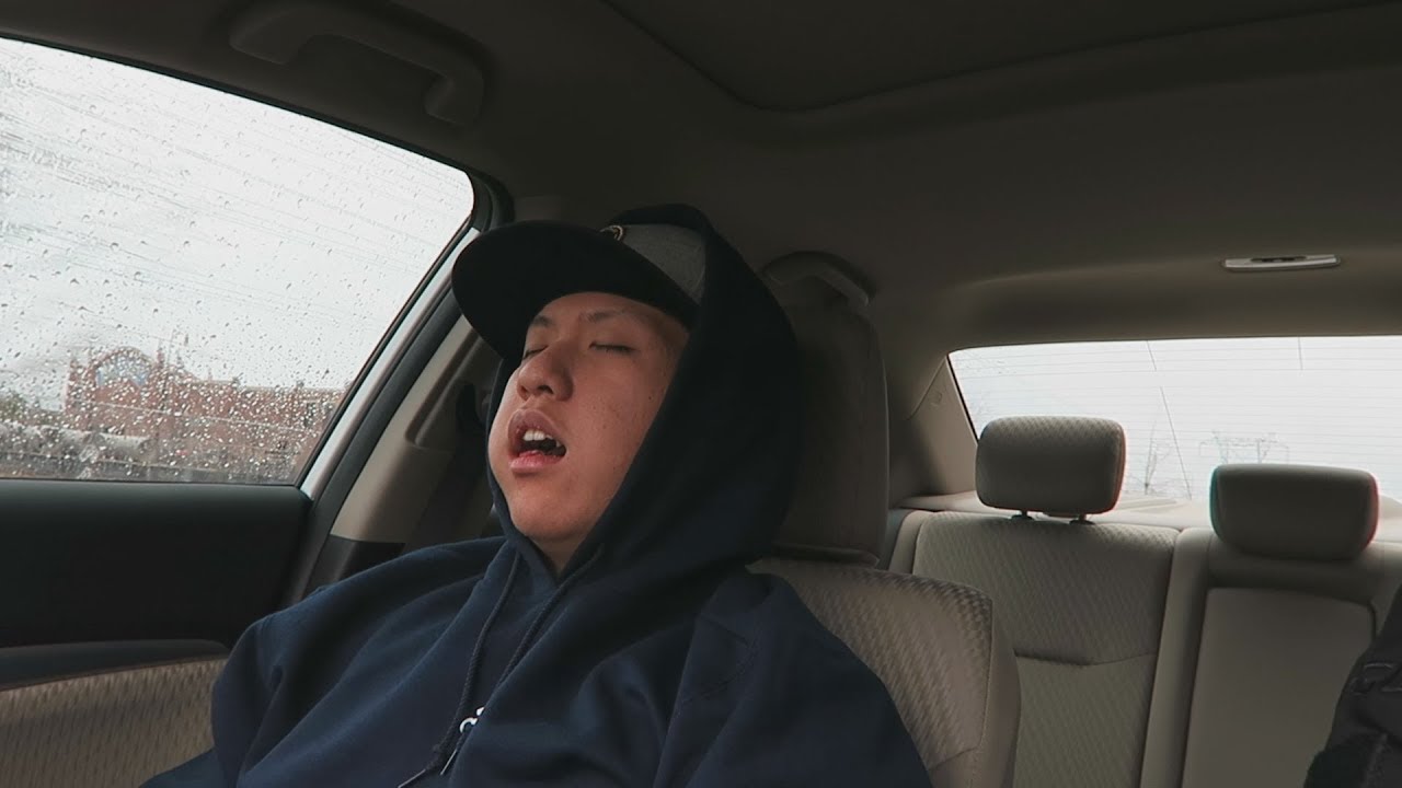 XPLOSIVE GETS HIS WISDOM TEETH REMOVED VLOG