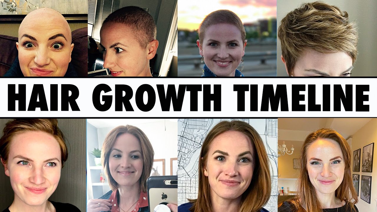 Post Chemo HAIR GROWTH (What to EXPECT)