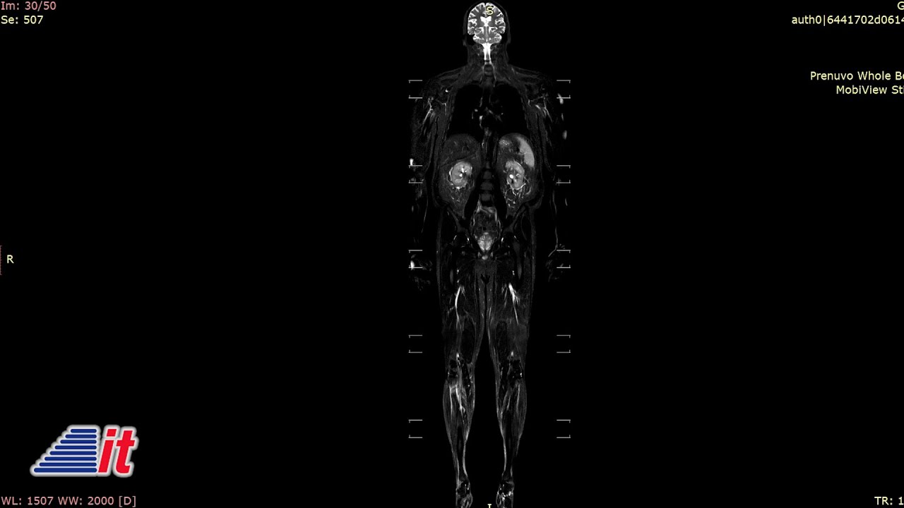 Prenuvo Whole Body Ai-Assisted Scan | Into Tomorrow