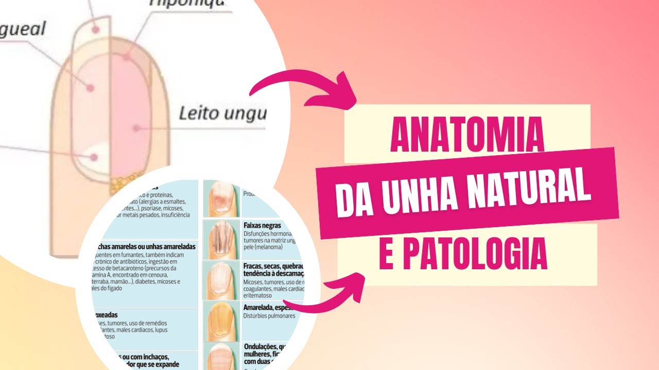 Anatomia da unha natural e patologias