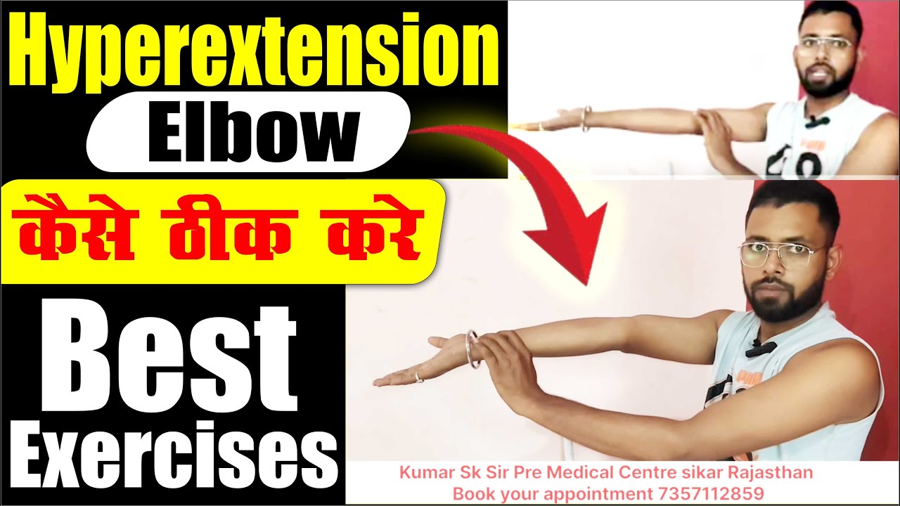 hyperextended elbow treatment.kohni ka tirchapan kaise thik kare.elbow deformity I Hyperextension