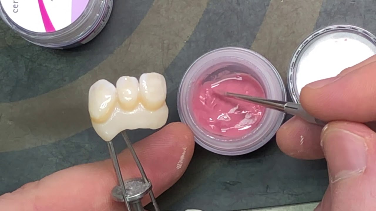 Light Teeth ))One bake Dentaurum Ceramotion One Touch Ceramotion No limits Ceramotion Pink