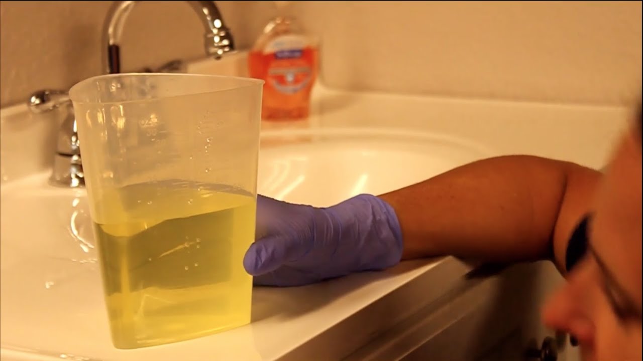 Colorado CNA | Skill 13 | Measures and Records Urinary Output