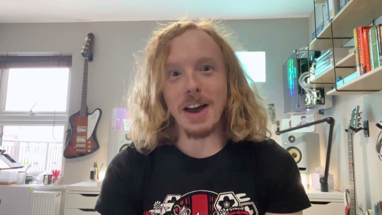 Starting to talk about my Hair Transplant