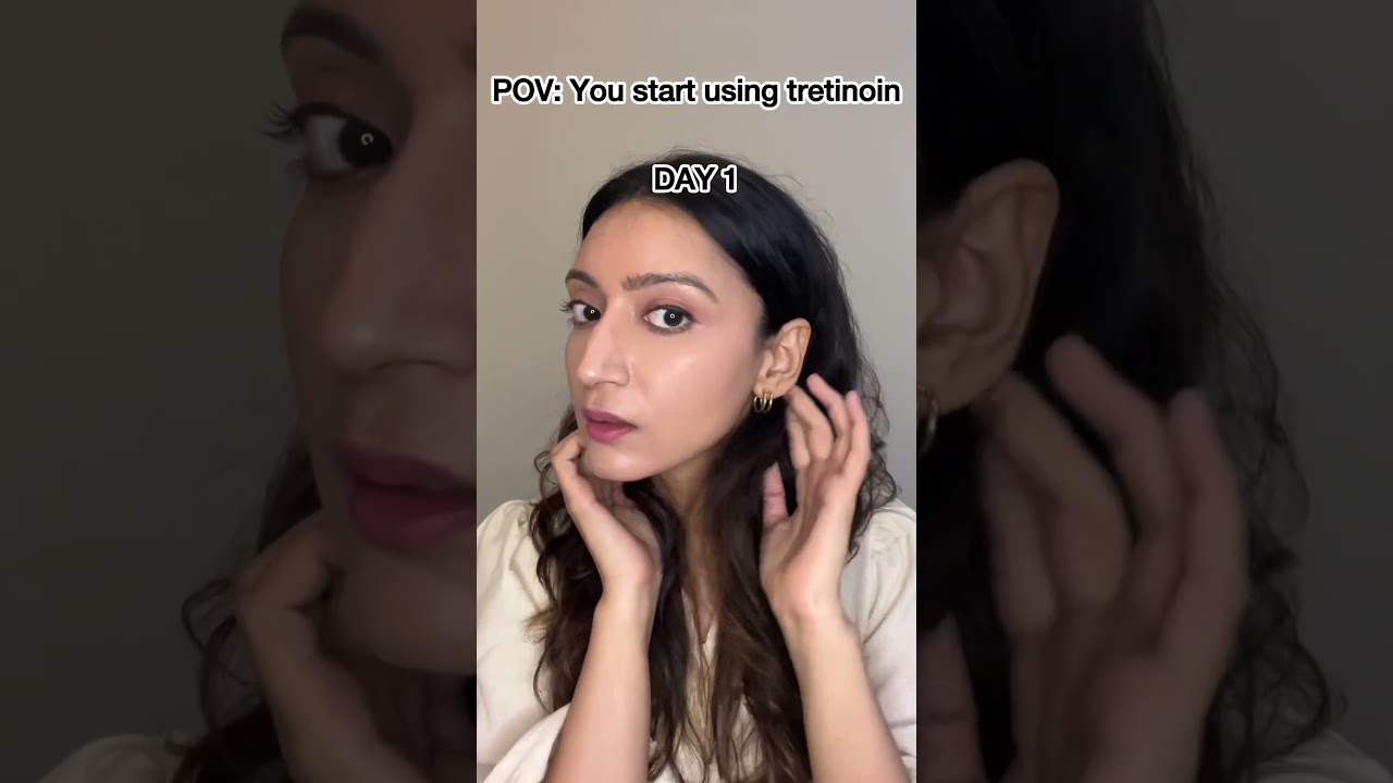 How to survive the tretinoin purge?Breakouts after starting tretinoin?Pimples from retinol/retinoids