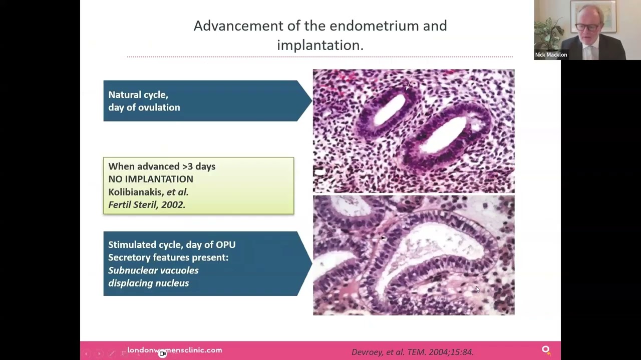 Endometrial Receptivity The Window of Implantation and Clinical Tests  Feb 20th