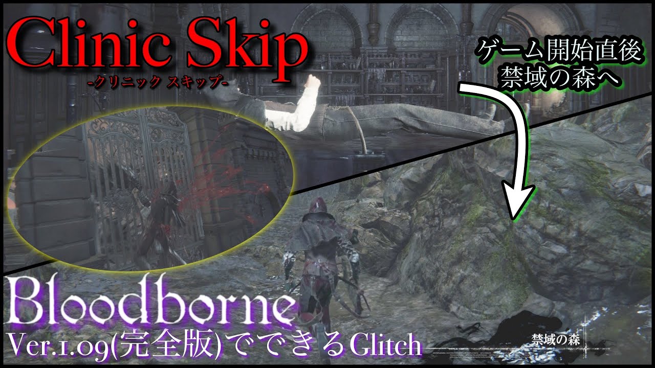 【Ver1.09 Glitch】「Clinic Skip」ゲーム開始直後→禁域の森【Bloodborne】