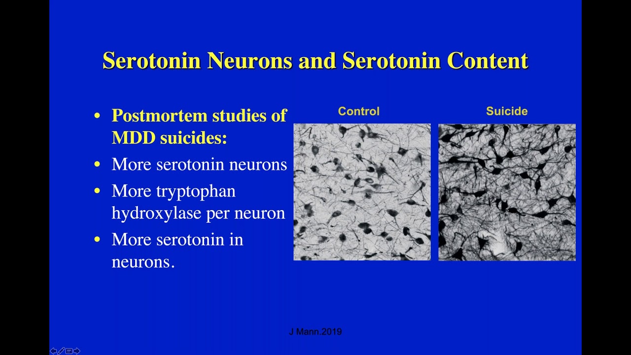 Brain Plasticity: The Effects of Antidepressants on Major Depression