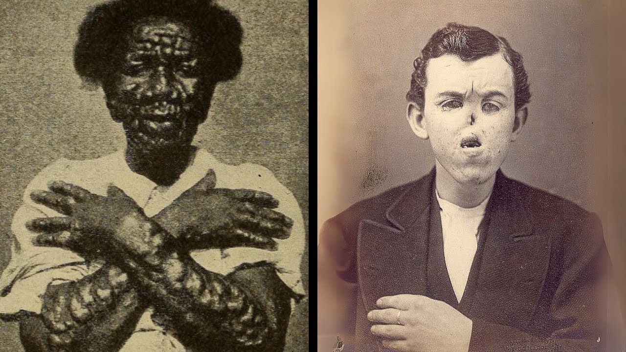 15 шокирующих цирковых чудаков, которые действительно существуют