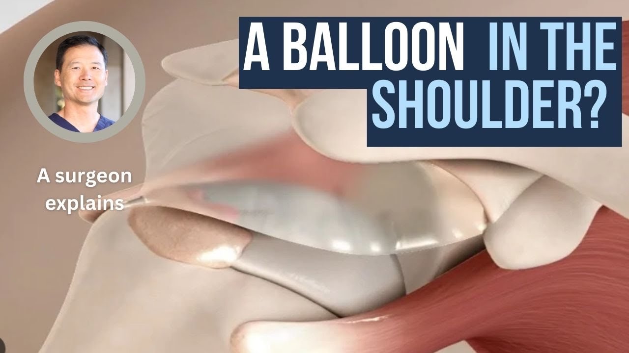 Balloon Spacer for Rotator Cuff Tears