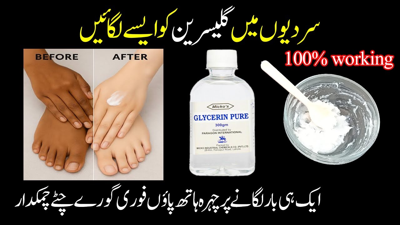 Apply Glycerin in winters in such a way that your hands and feet become milkywhite and soft over...