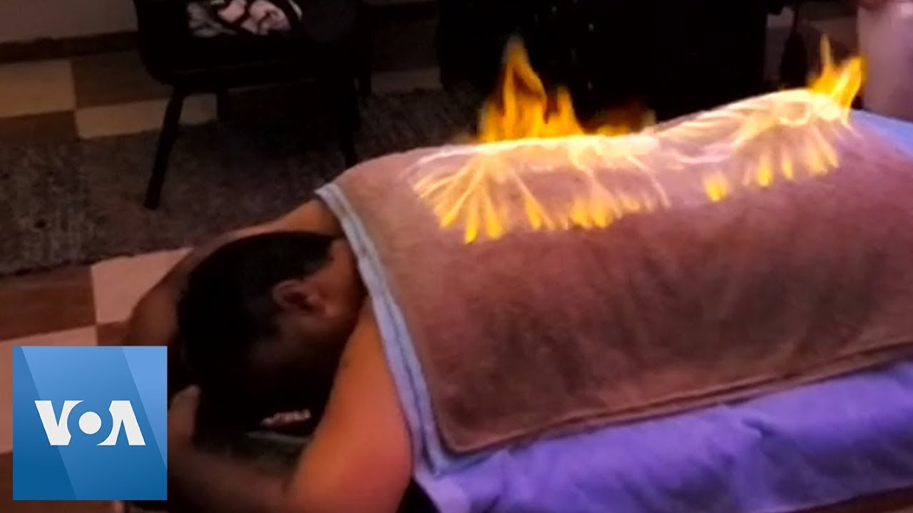 Fire Massages Relieve Back Pain in Egypt