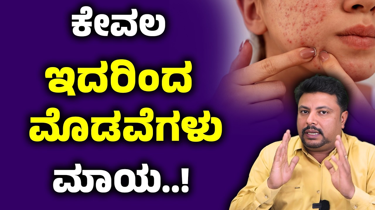 ಯಾವುದೇ ಕ್ರೀಮ್ ಸೋಪ್ ಬೇಡ ಇದರಿಂದ ಪಿಂಪಲ್ಸ್ ಗೆ ಪರಿಹಾರ | Pimple Acne Removal | Modave Tips In Kannada