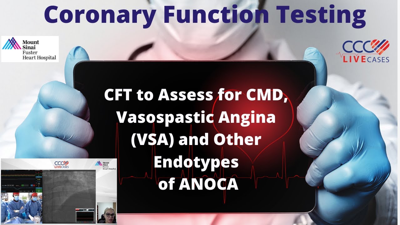 CFT to Assess for CMD, Vasospastic Angina (VSA) and Other Endotypes of ANOCA