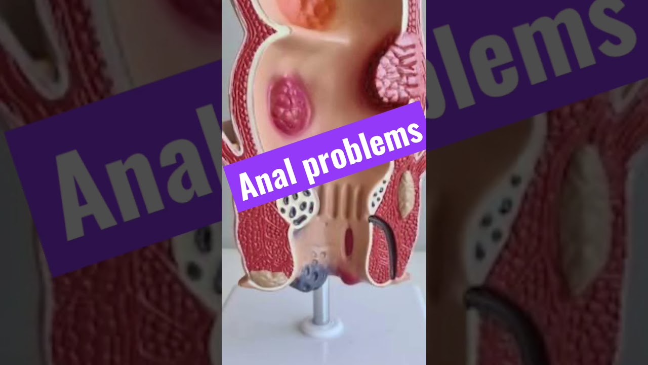 Anal Pain and Anal Problems I SURAT I MUMBAI I INDORE I India