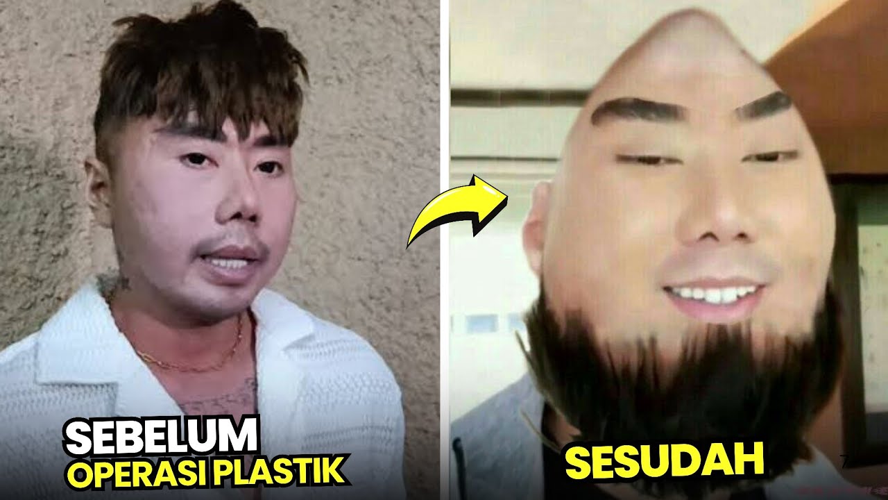 MUKA 99% PLASTIK, 8 Artis PRIA Lakukan operasi plastik di akhir tahun 2024