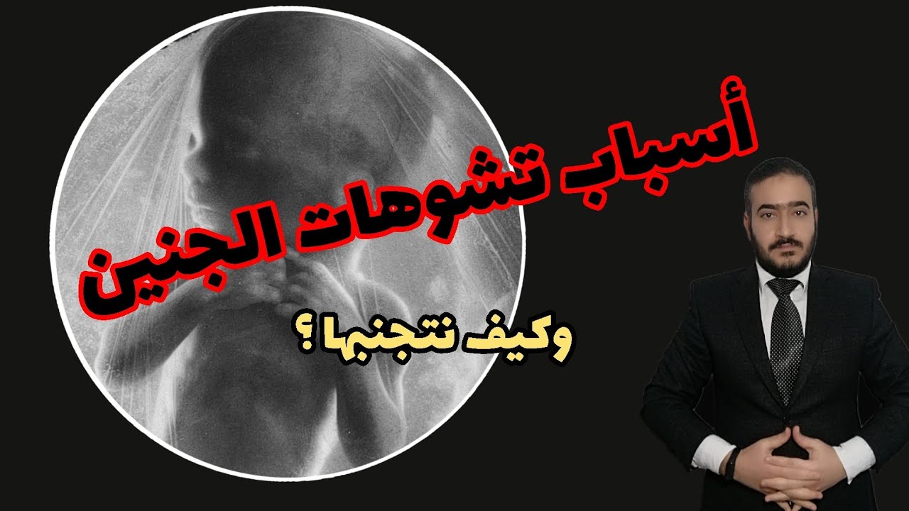 أسباب تشوهات الجنين وكيف نتجنبها