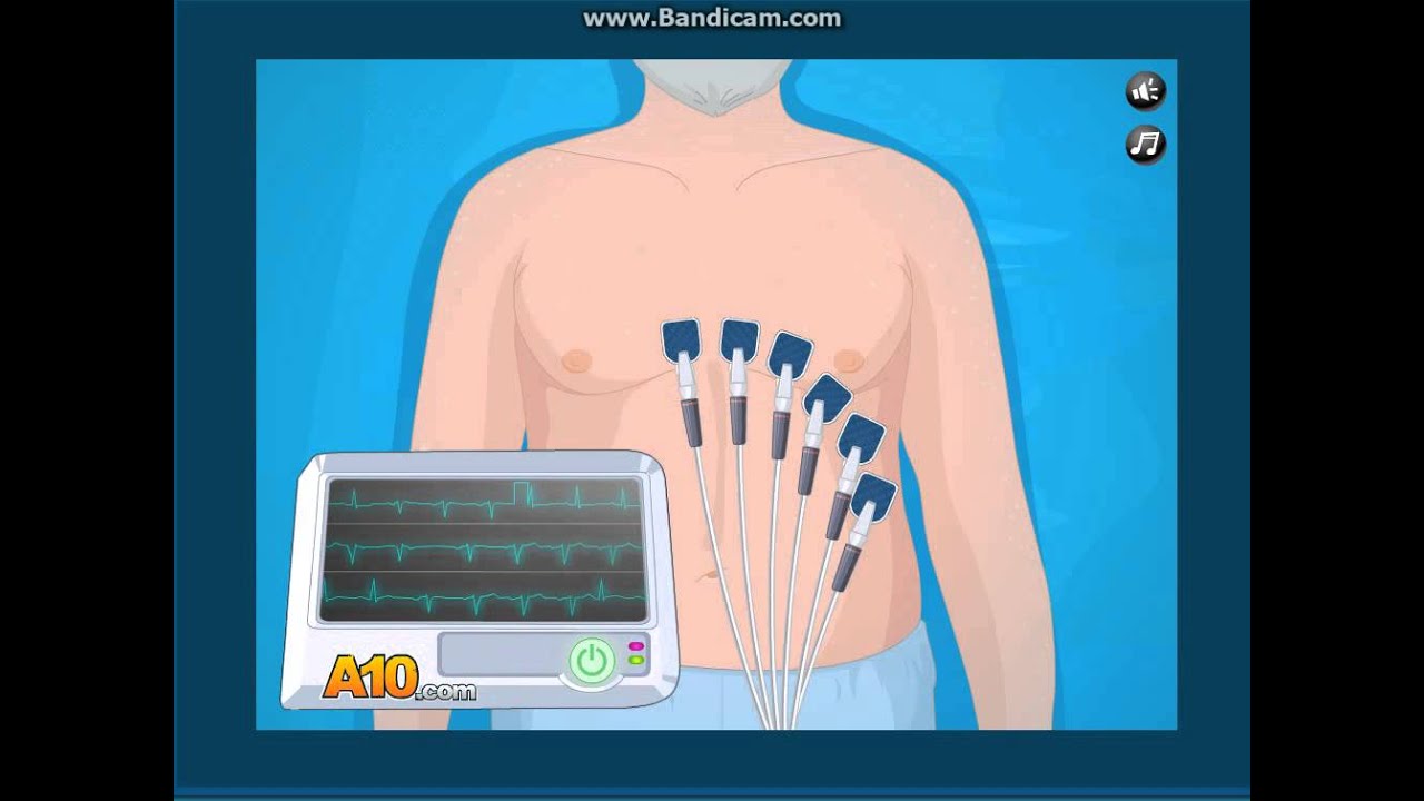 Operate Now : Pacemaker Surgery