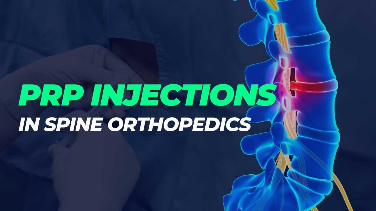What You Need to Know About PRP Injections in Spine Orthopedics