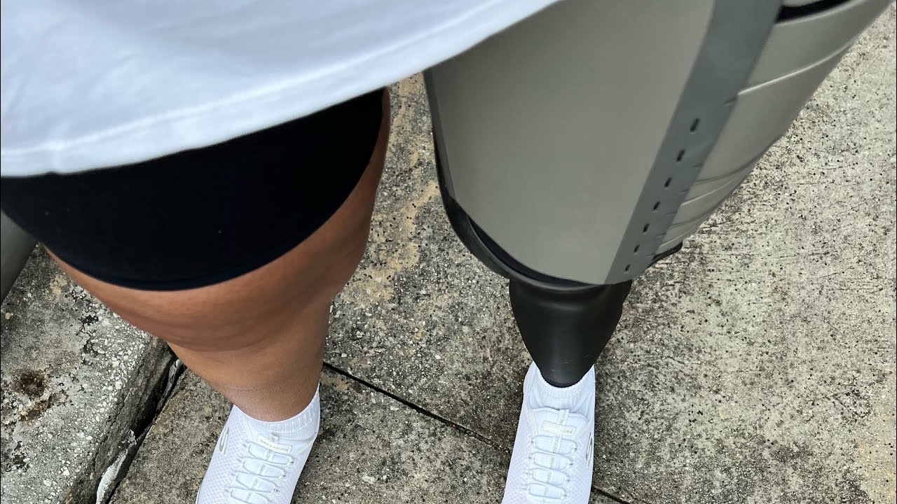 Introducing socket #3 - Ottobock Varos