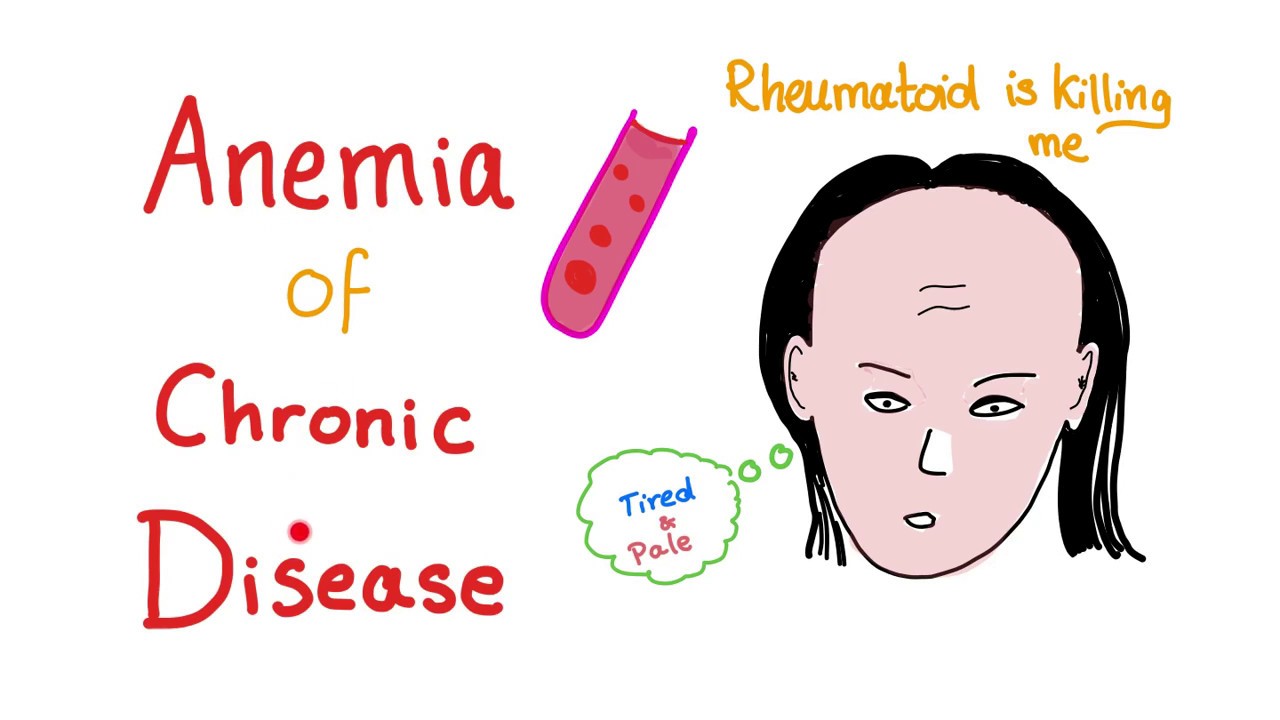Anemia of Chronic Disease - Anemia of Inflammation- All you need to know - Hematology Series