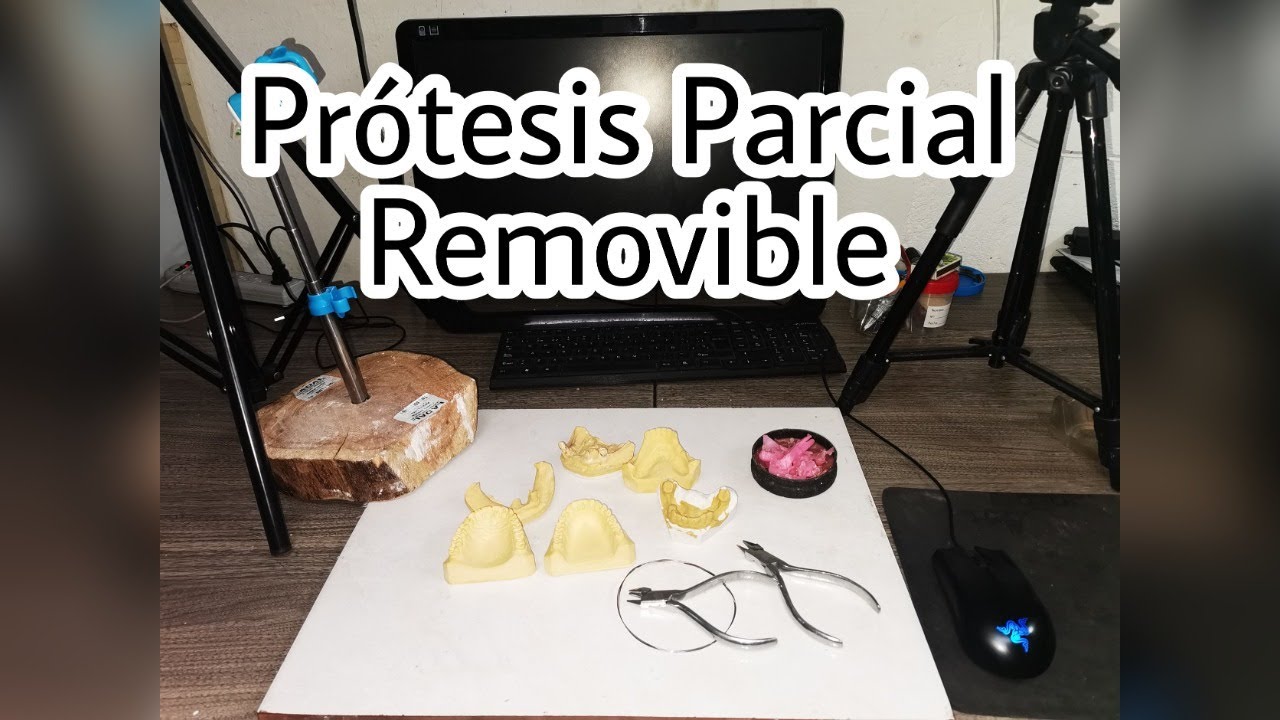CURSO PRÒTESIS PARCIAL REMOVIBLE