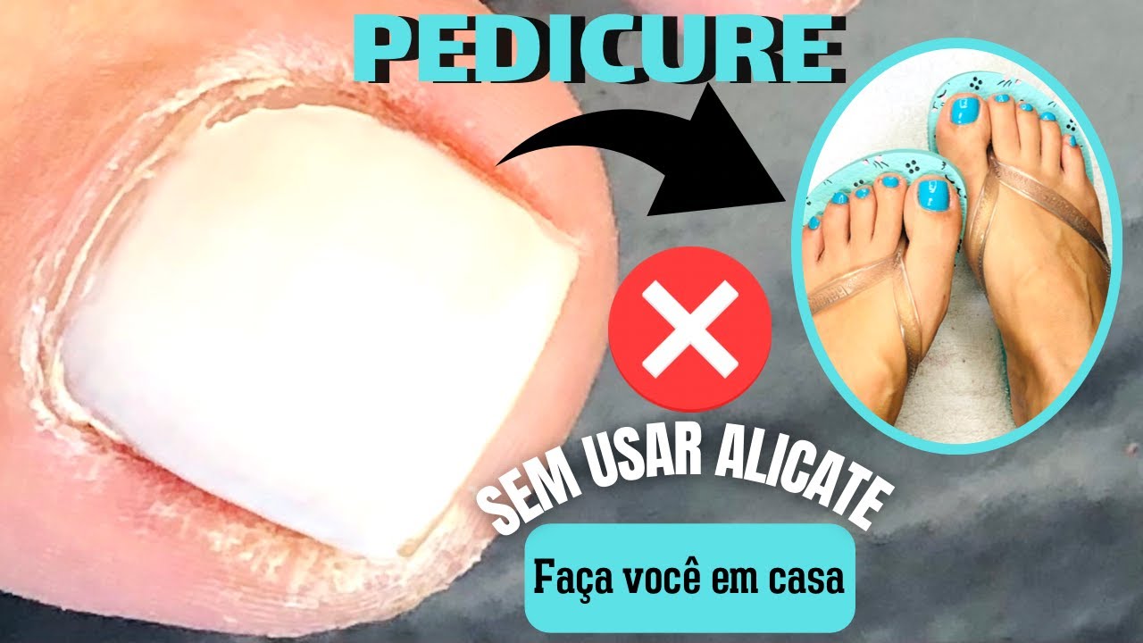 PEDICURE - UNHAS DOS PÉS PERFEITAS SEM USAR ALICATE                (PASSO A PASSO)